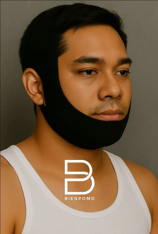 One-week transformation after large chin implant surgery.