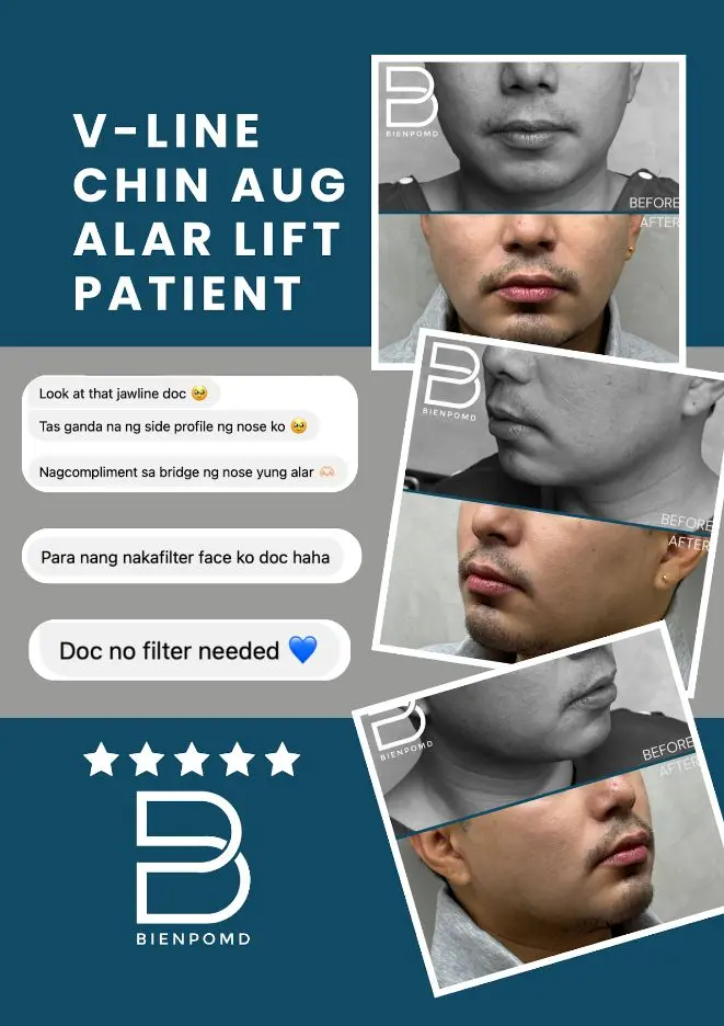 Chin Augmentation patient review about consultation, surgery, and follow-up care