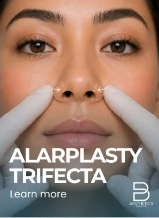 Alarplasty treatment artwork from BienPoMD