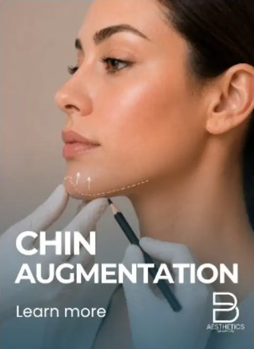 Chin Augmentation treatment artwork from BienPoMD