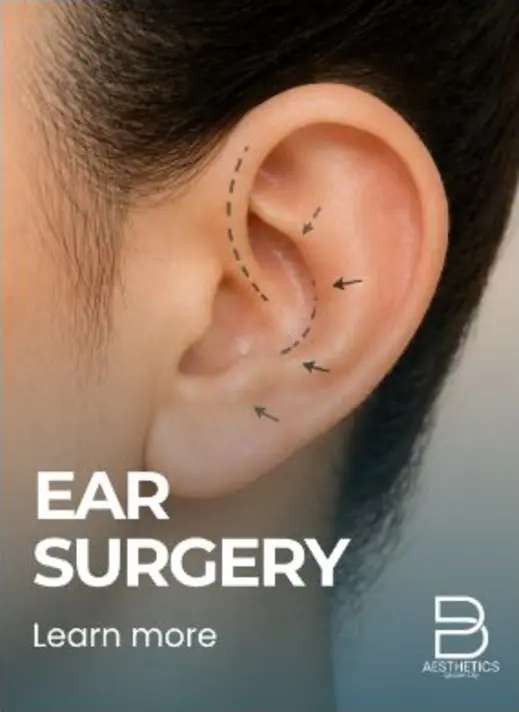 Otoplasty (Ear Surgery) treatment artwork from BienPoMD