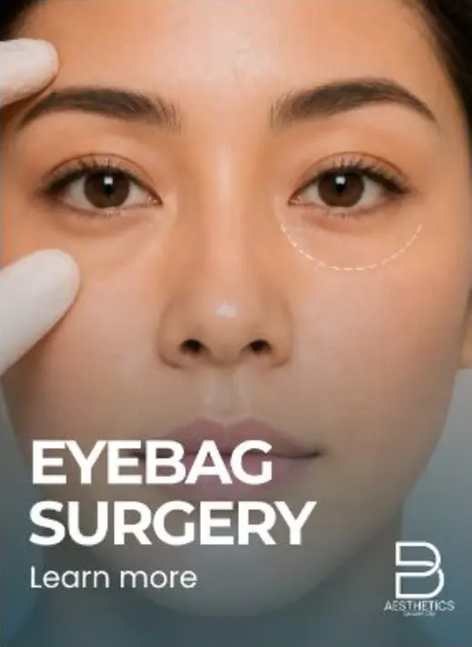 Eyebag Surgery treatment artwork from BienPoMD
