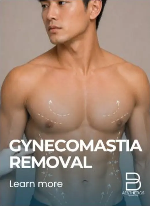 Gynecomastia Surgery treatment artwork from BienPoMD