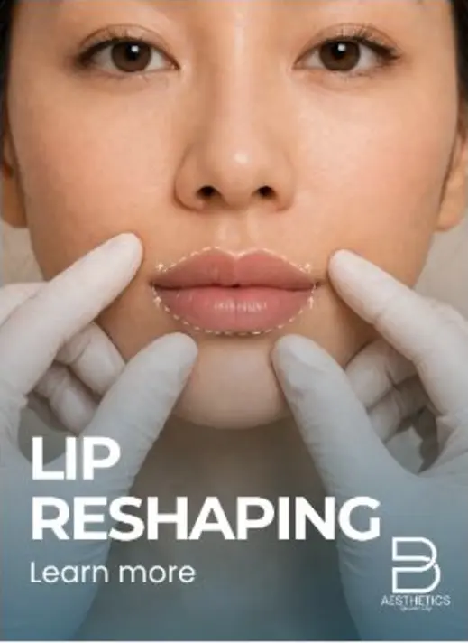 Lip Surgery treatment artwork from BienPoMD
