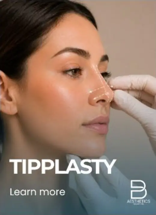 Tipplasty treatment artwork from BienPoMD