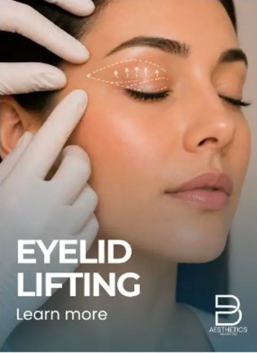 Upper Blepharoplasty treatment artwork from BienPoMD