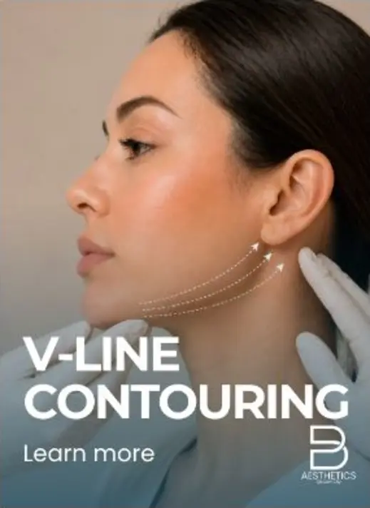 V-Line Liposuction treatment artwork from BienPoMD